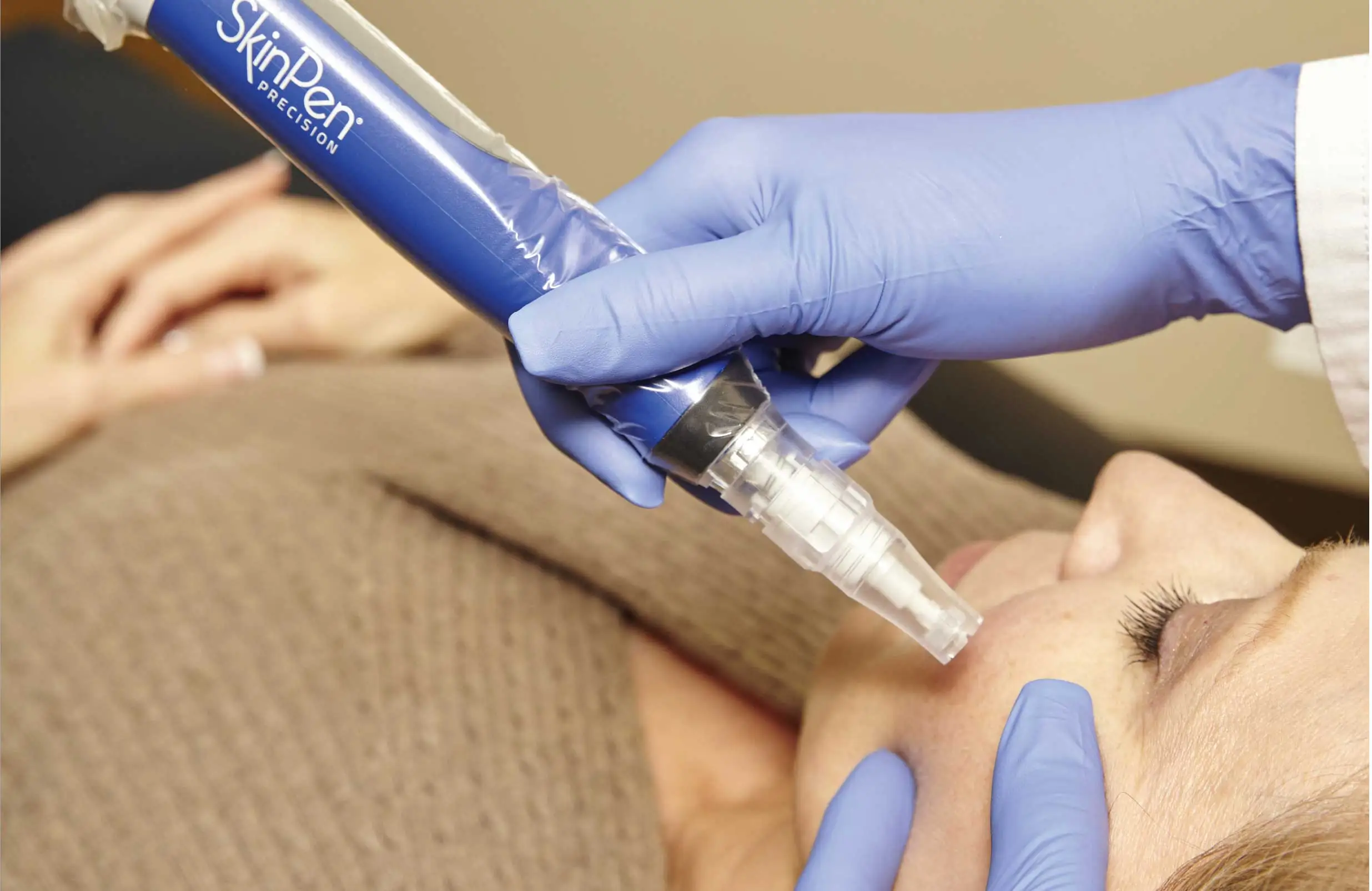 Microneedling in Kentfield, CA at Bare skin Marin