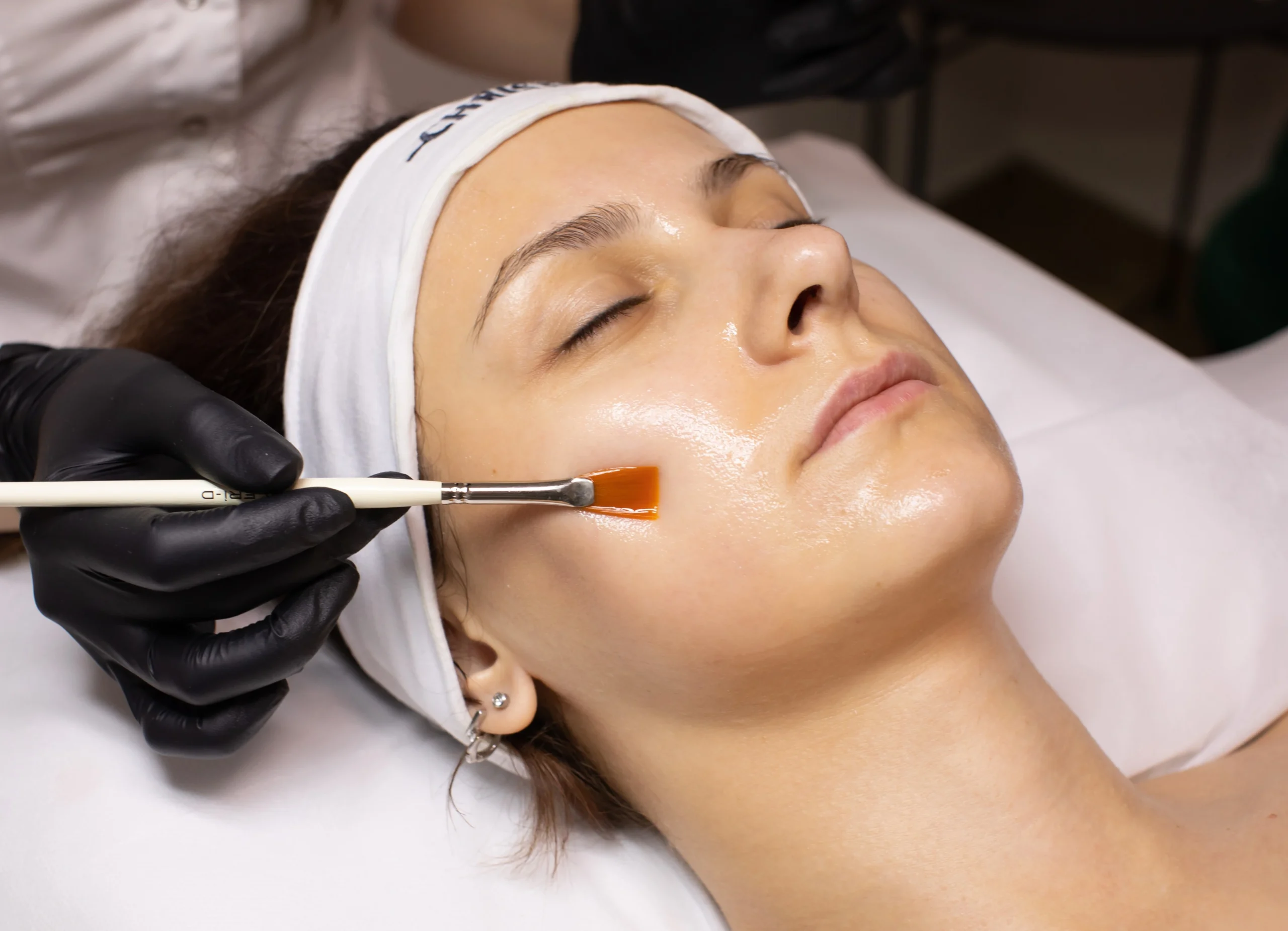 NoPeel Treatments in Kentfield, CA at Bare Skin Marin
