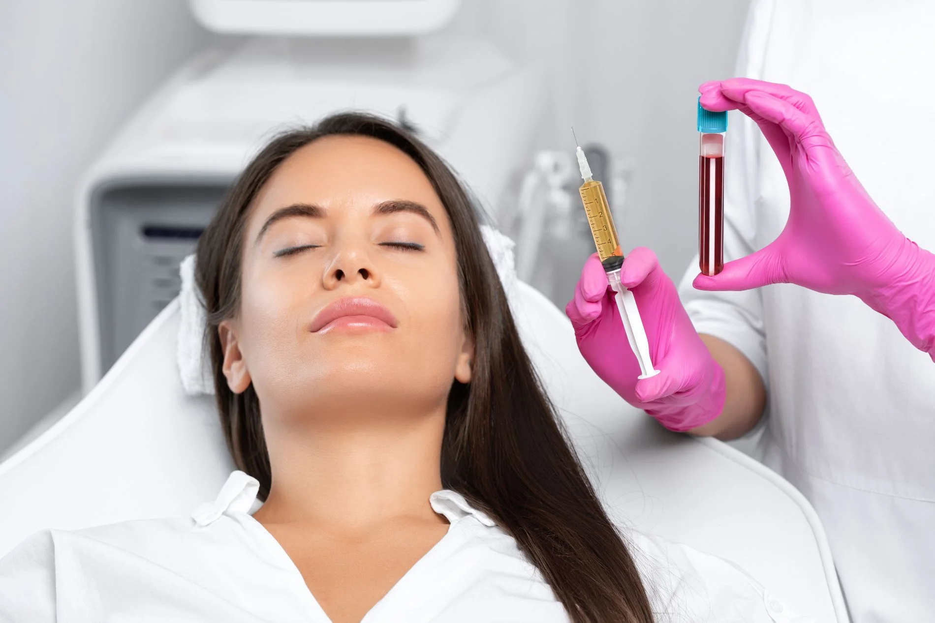 PRF Treatment in Kentfield, CA by Bare Skin Marin