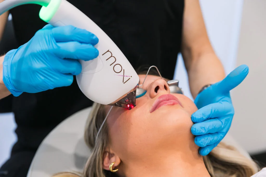 MOXI Laser Treatments in Kentfield, CA at Bare Skin Marin