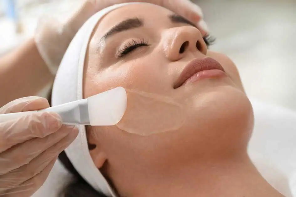 VI Peel Treatments in Kentfield, CA by Bare Skin Marin