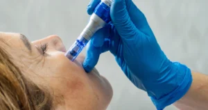 Woman receives microneedling treatment in Kentfield, CA